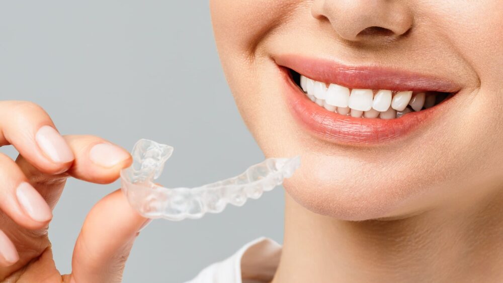 Καπλαμάδες ή Invisalign για πιο ίσια δόντια