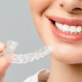 Καπλαμάδες ή Invisalign για πιο ίσια δόντια;