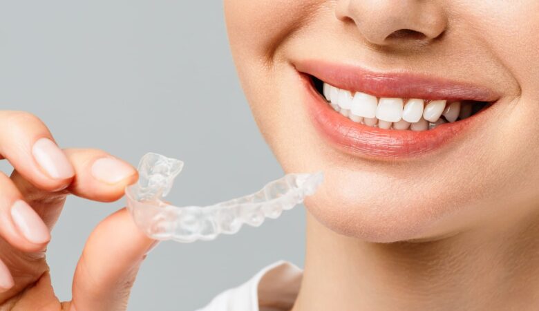 Καπλαμάδες ή Invisalign για πιο ίσια δόντια