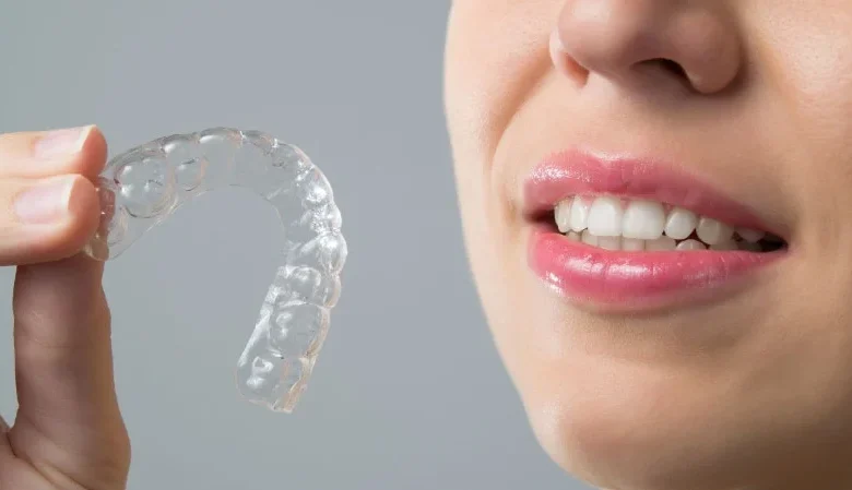 Τι ξεχωρίζει τα Invisalign Aligners από τα παραδοσιακά σιδεράκια;