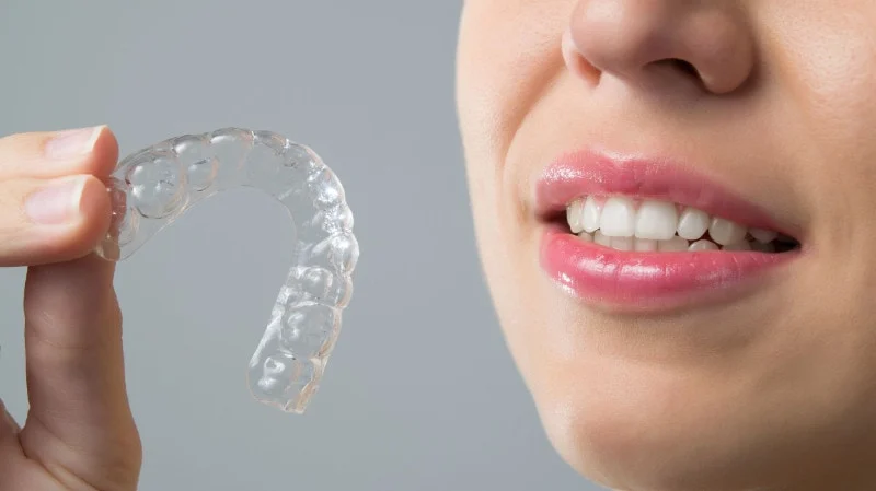 Τι ξεχωρίζει τα Invisalign Aligners από τα παραδοσιακά σιδεράκια